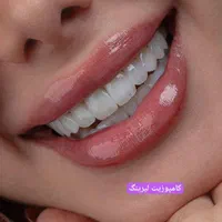 دندانپزشکی ایمپلنت کامپوزیت ارتودنسی لمینت روکش
