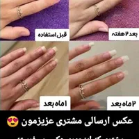 سرم دوفاز تقویت ناخن ویتابلا|آرایشی، بهداشتی، درمانی|تهران, پرواز|دیوار