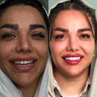 دندان پزشکی اقساطی ۱۲ماهه بدون پیش پرداخت|خدمات آرایشگری و زیبایی|تهران, خانی آباد نو شمالی|دیوار