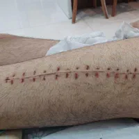 تزریقات خدمات پرستاری وصل سرم درمنزل|خدمات آرایشگری و زیبایی|کرج, عظیمیه|دیوار