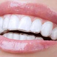 ساخت انواع پروتز های دندانی. دندان مصنوعی|خدمات آرایشگری و زیبایی|شیراز, لب آب|دیوار