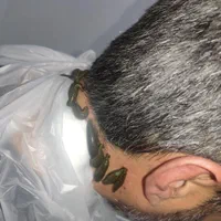 حجامت بختیاری ها،طب سنتی سوزنی ،فصد،زالو prp|خدمات آرایشگری و زیبایی|اصفهان, باغ دریاچه|دیوار