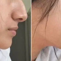 جراحی و‌ عمل  زیبایی صورت و‌بدن|خدمات آرایشگری و زیبایی|تهران, سهروردی|دیوار