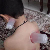 حجامت وبادکش|خدمات آرایشگری و زیبایی|ماهدشت, |دیوار