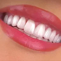 زیبایی لبخندتان را به ما بسپارید