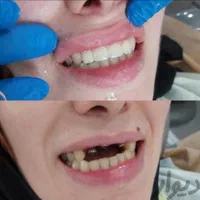 کلینیک تخصصی دندانپزشکی و ایمپلنت  در سیرجان|خدمات آرایشگری و زیبایی|سیرجان, |دیوار