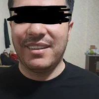 دست دندان مصنوعی طرح لمینت زیبایی تا ۶ ماه اقساط|خدمات آرایشگری و زیبایی|تبریز, |دیوار