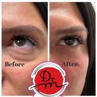 ژل بوتاکس نخ بلفاروپلاستی اندولیفت کاشت لیزر|خدمات آرایشگری و زیبایی|فردیس, فردیس|دیوار