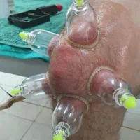 حجامت وبادکش|خدمات آرایشگری و زیبایی|ماهدشت, |دیوار