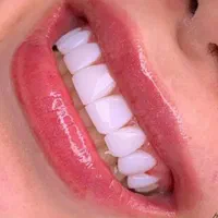 دندان پزشکی|خدمات آرایشگری و زیبایی|قائمشهر, |دیوار