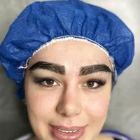 کاشت مدل ابرو با تراکم بالا