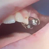 دندانپزشکی اطفال کودک‌ و نوجوان فردیس کرج|خدمات آرایشگری و زیبایی|فردیس, فردیس|دیوار
