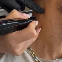پاک کردن تتو ریموو ابرو کربن تراپی خال بردراری|خدمات آرایشگری و زیبایی|کرج, مهرویلا جنوبی|دیوار