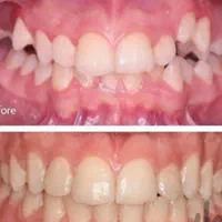 ارتودنسی اقساط بدون پیش پرداخت