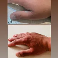 ورزش درمانی کمر زانو شانه لاغری سریع|خدمات آموزشی|تهران, زعفرانیه|دیوار