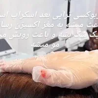 درمان ریزش مو و رشد مجدد مو فقط در چند جلسه|خدمات آرایشگری و زیبایی|قوچان, |دیوار