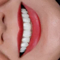کلینیک دندانپزشکی ایمپلنت ارتودنسی زیبایی درمانی