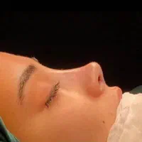 عمل بینی فقط ماهی ۵ میلیون|خدمات آرایشگری و زیبایی|تهران, مهران (سیدخندان)|دیوار