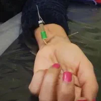 امبدینگ موکساتراپی حجامت طب سوزنی بادکش فصد زگیل|خدمات آرایشگری و زیبایی|اصفهان, مسجد مصلی|دیوار