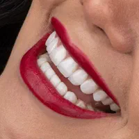 ایمپلنت دندان دندانپزشکی کامپوزیت لمینت کلیه خدمات|خدمات آرایشگری و زیبایی|شهرکرد, |دیوار