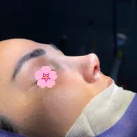 عمل بینی ۲۳ میلیون در تخفیفات|خدمات آرایشگری و زیبایی|تهران, میدان ولیعصر|دیوار