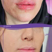 مشاوره لب / خانم دکتر ساجدی