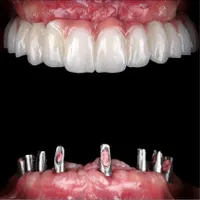 کلینیک تخصصی دندانپزشکی و ایمپلنت دکتر دانشور|خدمات آرایشگری و زیبایی|شیراز, معالی‌آباد|دیوار