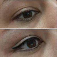 ژل،بوتاکس، لیزرخال و تاتو،ریمور|خدمات آرایشگری و زیبایی|قم, نیروگاه|دیوار