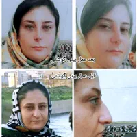 عمل جراحی بینی بامتخصص گوش،حلق،بینی|خدمات آرایشگری و زیبایی|تهران, ونک|دیوار