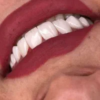 خدمات دندان پزشکی لمینت و کامپوزیت زیبایی|خدمات آرایشگری و زیبایی|تهران, جمهوری|دیوار