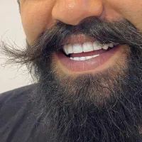 جشنواره کامپوزیت دندان|خدمات آرایشگری و زیبایی|فردیس, فردیس|دیوار