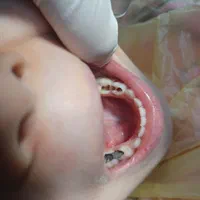 دندانپزشکی اطفال کودک‌ و نوجوان فردیس کرج|خدمات آرایشگری و زیبایی|فردیس, فردیس|دیوار