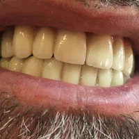 دندانسازی/دندان مصنوعی/بامجوزرسمی و۷۰سال سابقه|خدمات آرایشگری و زیبایی|مشهد, پایین خیابان|دیوار