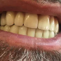 دندانسازی/دندان مصنوعی/بامجوزرسمی و۷۰سال سابقه|خدمات آرایشگری و زیبایی|مشهد, پایین خیابان|دیوار