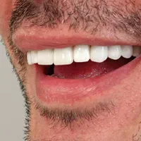 دندانپزشکی نقدواقساط باتخفیفات بینظیر فقط بمدت۷روز|خدمات آرایشگری و زیبایی|شیراز, ملاصدرا|دیوار