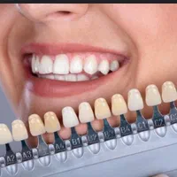 تخفیف ویژه کامپوزیت و لمینت با بهترین متخصصان|خدمات آرایشگری و زیبایی|شیراز, فرهنگ شهر|دیوار