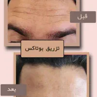 مرکز زیبایی دکتر تقوی|خدمات آرایشگری و زیبایی|یاسوج, |دیوار