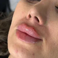 جشنواره ژل بوتاکس آنزیم فیلر پرسینگ فشیال پاکسازی|خدمات آرایشگری و زیبایی|مشهد, صیاد شیرازی|دیوار