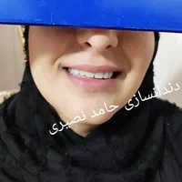 دندان مصنوعی دندانسازی حامد نصیری|خدمات آرایشگری و زیبایی|خرمآباد, |دیوار