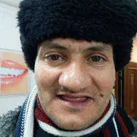 کارگاه ساخت دست دندان مصنوعی و لمینیت|خدمات آرایشگری و زیبایی|تهران, شهرک شریعتی|دیوار