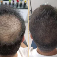 مرکز تخصصی میکرو اسکالپ شهبازی
