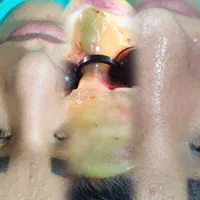فیشیال ،پاکسازی و جوانسازی و روشن سازی صورت و دست|خدمات آرایشگری و زیبایی|تهران, جنت‌آباد مرکزی|دیوار