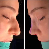جراحی و‌ عمل  زیبایی صورت و‌بدن|خدمات آرایشگری و زیبایی|تهران, سهروردی|دیوار