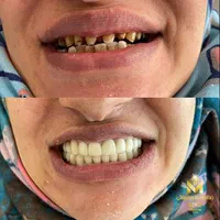 دندانسازی رویال (مرادلو)|خدمات آرایشگری و زیبایی|تهران, قنات‌کوثر|دیوار