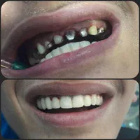 مطب دندانپزشکی واقع در مرکز شهر (نادری )|خدمات آرایشگری و زیبایی|اهواز, نادری|دیوار