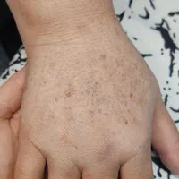 مدل پاکسازی و فیشال پوست با ۴ سال سابقه کار|خدمات آرایشگری و زیبایی|مشهد, صیاد شیرازی|دیوار
