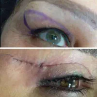 اقساط -کلینیک جراحی زیبایی دکتر محمدی مقام-اقساط|خدمات آرایشگری و زیبایی|اهواز, کوروش|دیوار