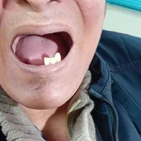 دندانسازی راشد|خدمات آرایشگری و زیبایی|مشهد, رستگار|دیوار