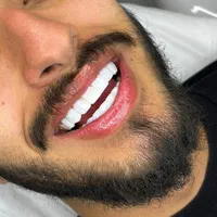 دندانپزشکی.کامپوزیت دندان .عصب کشی .لمینت.روکش|خدمات آرایشگری و زیبایی|تهران, تهرانپارس شرقی|دیوار