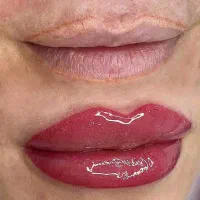 ۴۰٪تخفیف پاک‌کردن تاتو صورت میکرو ابرو تا آخر هفته|خدمات آرایشگری و زیبایی|دزفول, |دیوار